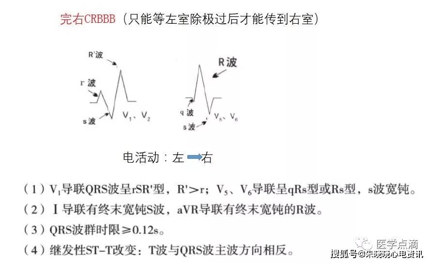 心电图零基础入门干货满满