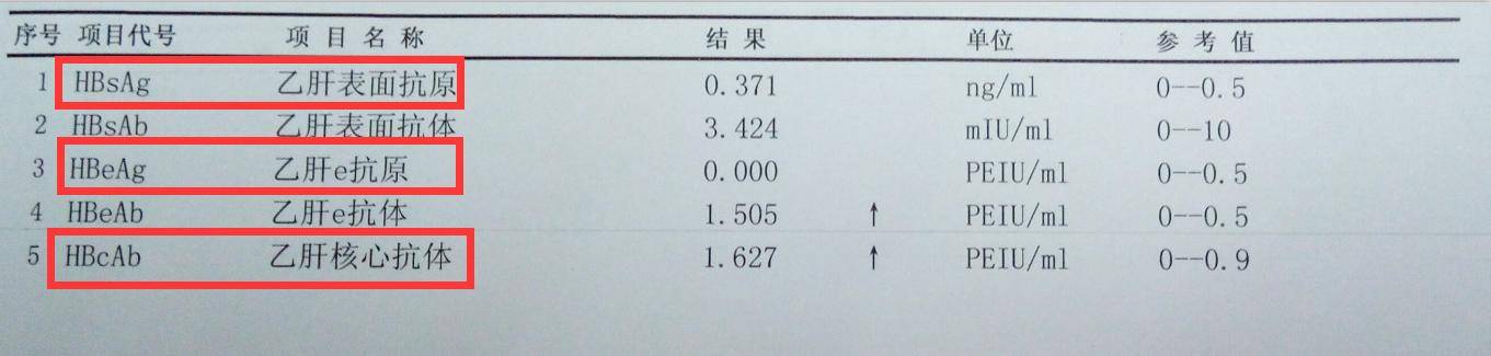 详细讲解肝功化验单,乙肝五项怎么看?看完再决定要不要打疫苗