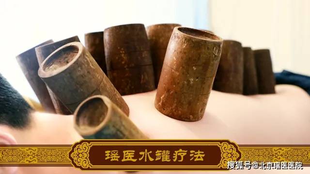 您拔过"水药罐"吗?北京瑶医邀您体验拔罐 药物治疗 热疗的三重效果