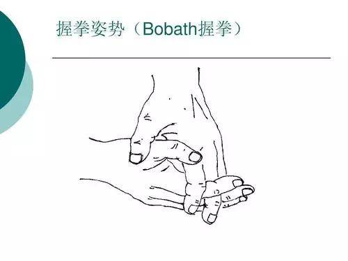 握手:两手握在一起,十指交叉,患侧拇指位于最上面,双手叉握充分向前