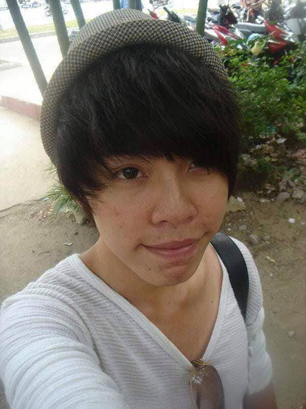男子长相丑陋遭人嘲笑长大后整容10次如今改头换面酷似男明星