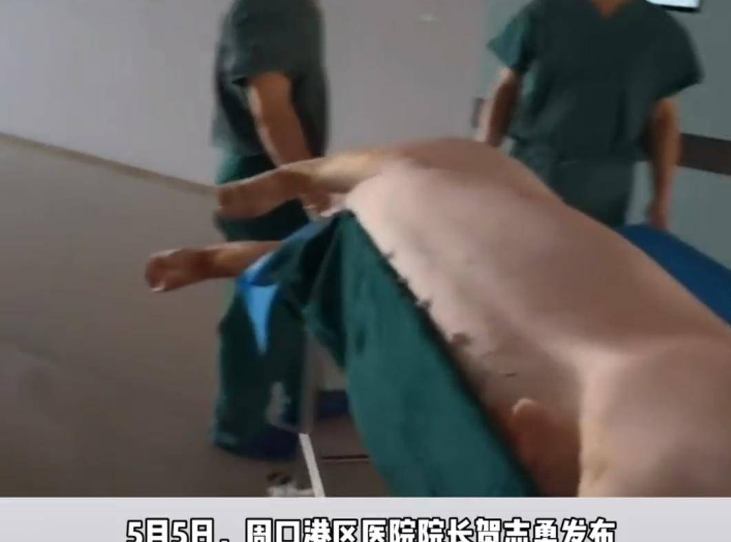 原创河南一医院用猪皮给患者植皮,网友:移植成功后,不会长出猪毛吧