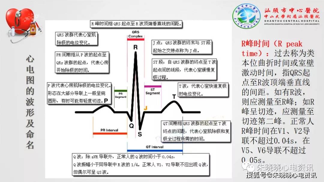 心电图要点知识汇总(ppt)