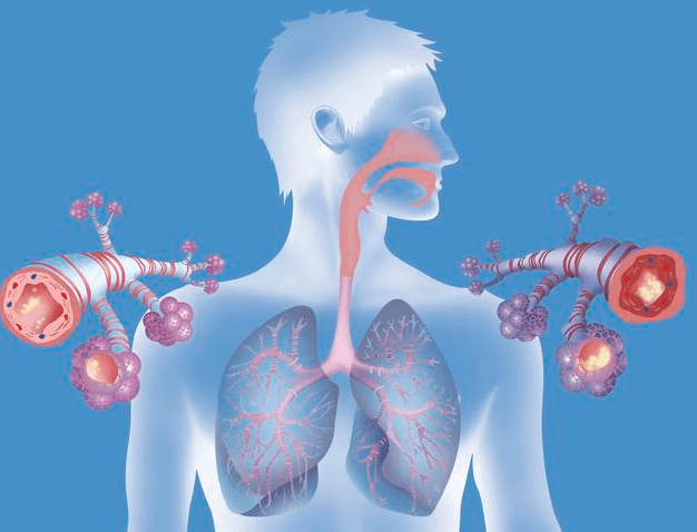 肺气肿和肺心病的区别,肺气肿的治疗根本是什么?