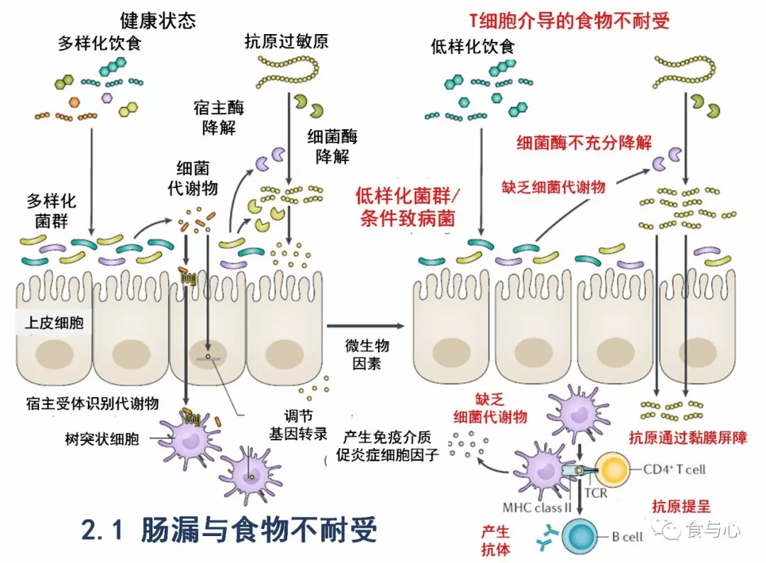 2 肠漏与食物过敏2.3 肠漏与ibs2.4 肠漏与乳糜泻2.5 肠漏与ibd2.