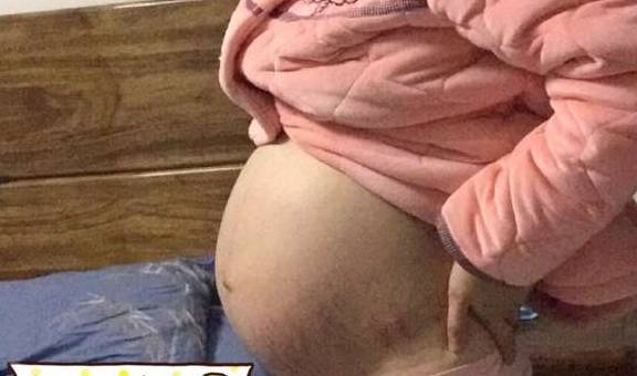 3年生两娃,儿子女儿都有了,给孕妈说说两胎的孕中症状