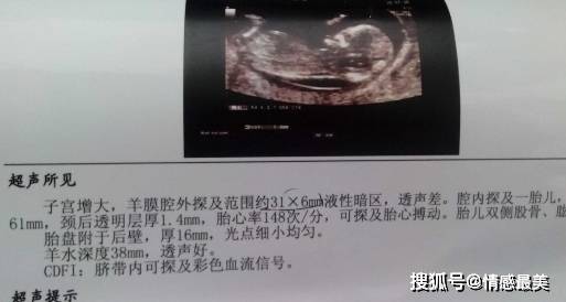 12周胎儿男生殖突出,男胎儿小鸡与女胎区别 怀孕12周的这项检查很重要,孕妈又了解多少呢?_胎儿