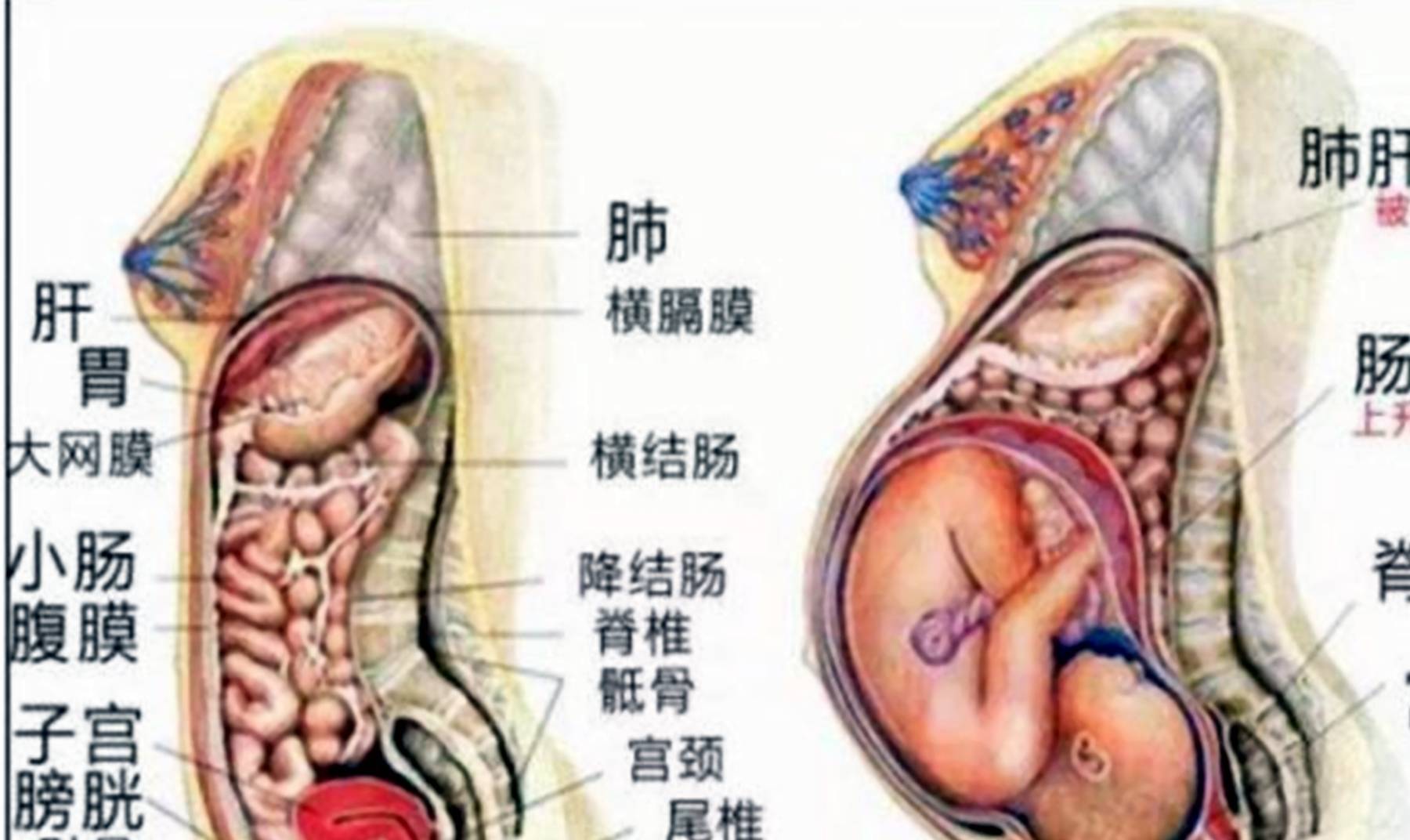 一天十几趟厕所,内脏被挤压的痛苦