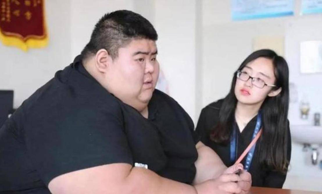天无绝人之路,2018年5月山东齐鲁医院开展了一个,肥胖的公益活动