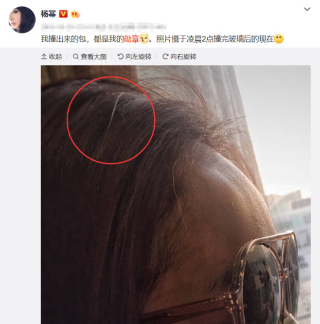 盘点年纪轻轻就长白头发的八大美女明星,你最心疼谁?