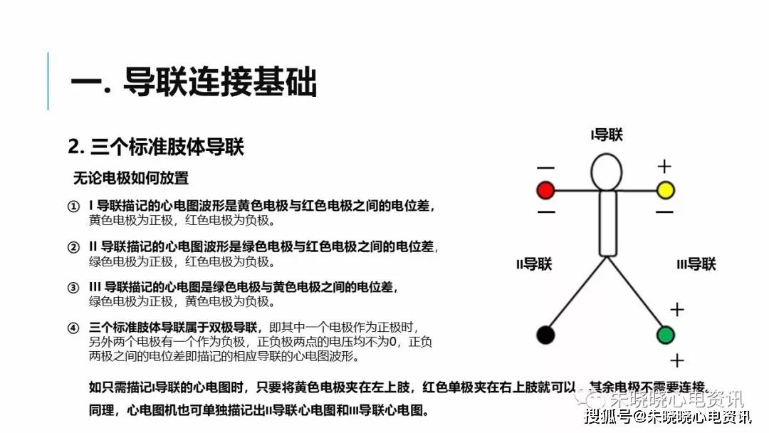 肢体导联电极错接心电图分析及鉴别ppt