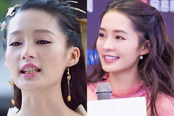 "整牙"如换头的5位女星:杨幂变瓜子脸,baby气质突变!