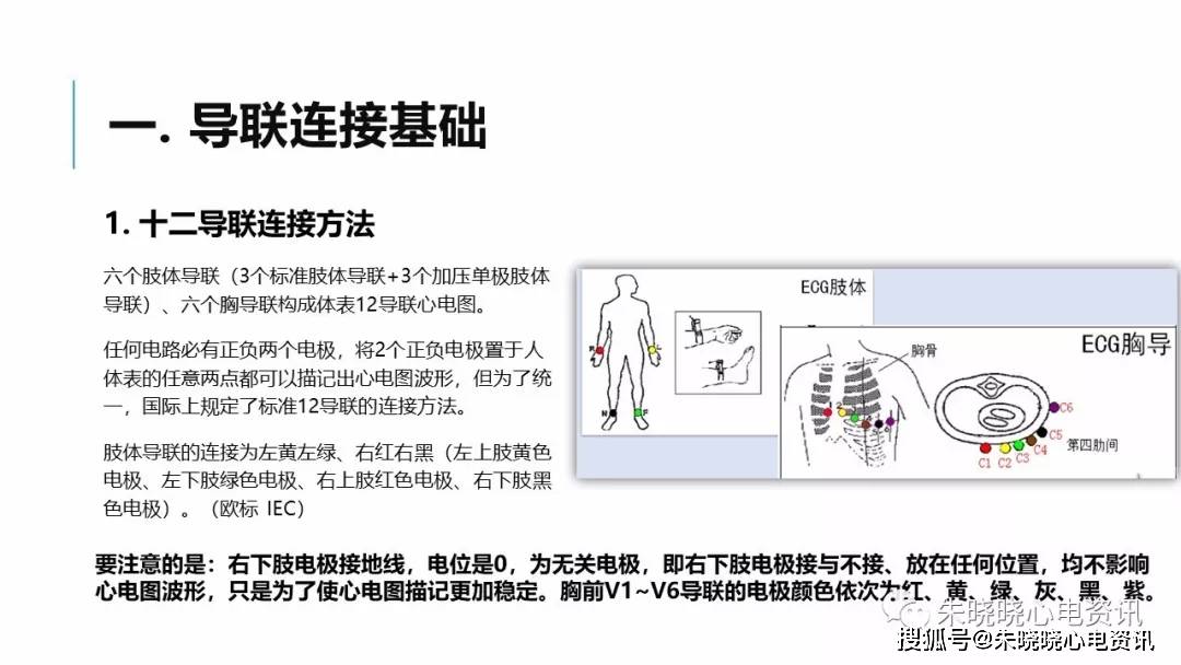 肢体导联电极错接心电图分析及鉴别ppt