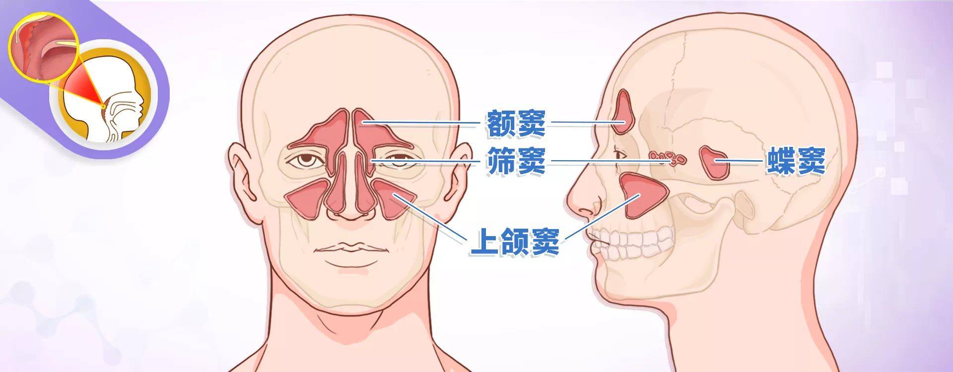 打鼾睡的香娃儿睡觉打鼾面容越来越丑需警惕