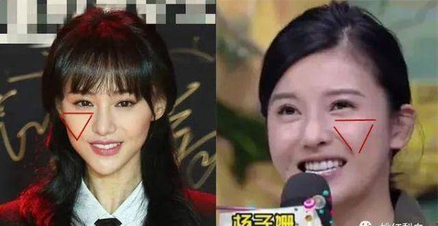 整容脸女星的头,又为何变发面馒头?