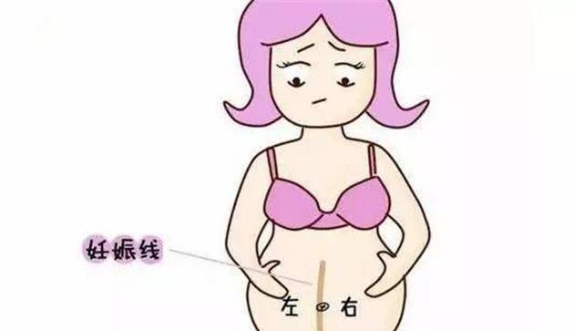 4,看肚脐线左右 妊娠线明显偏向左侧,一般都是生男孩为多;明显偏右侧