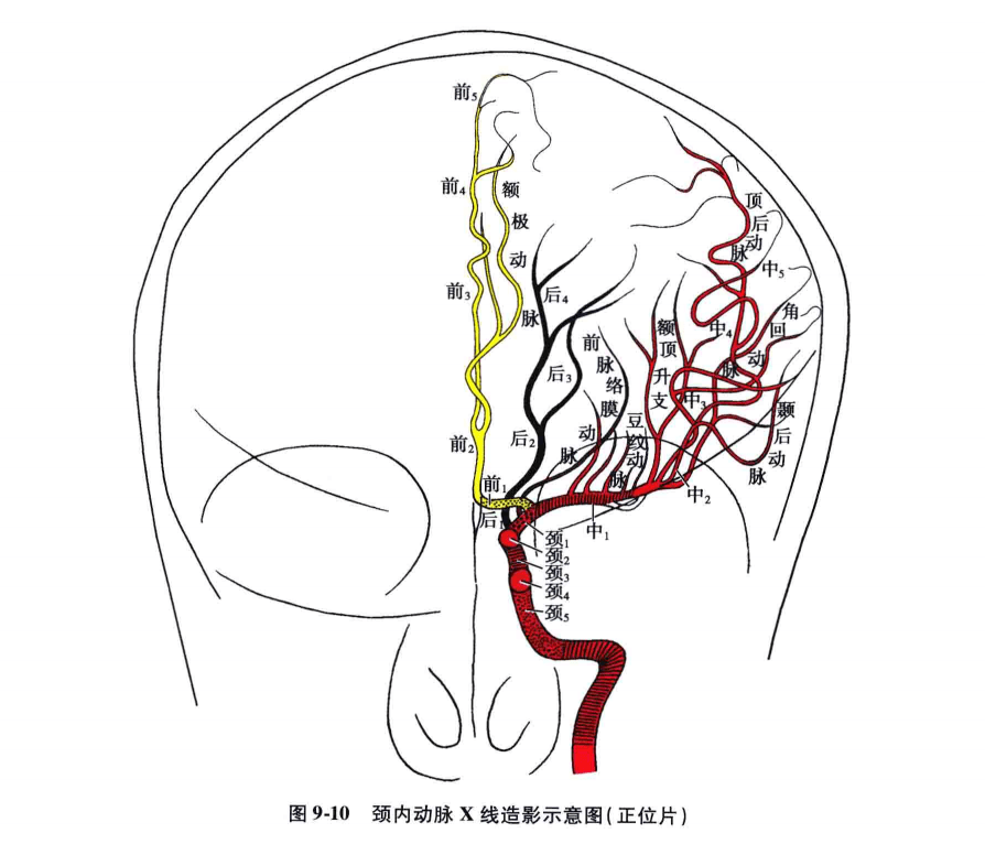 正常颈内动脉造影的解剖分段:正常颈内动脉x线造影的解剖分段,一般可
