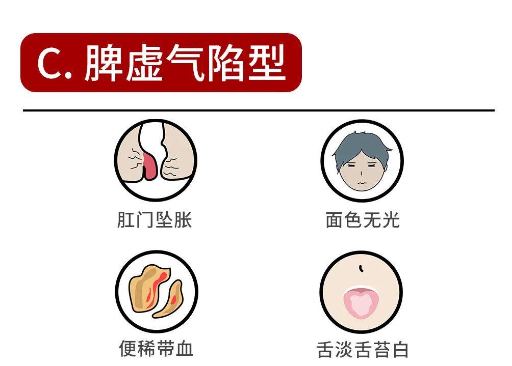 风伤肠络型【痔疮的症状】拉臭臭时带鲜血,伴随着口干舌燥和便秘症状