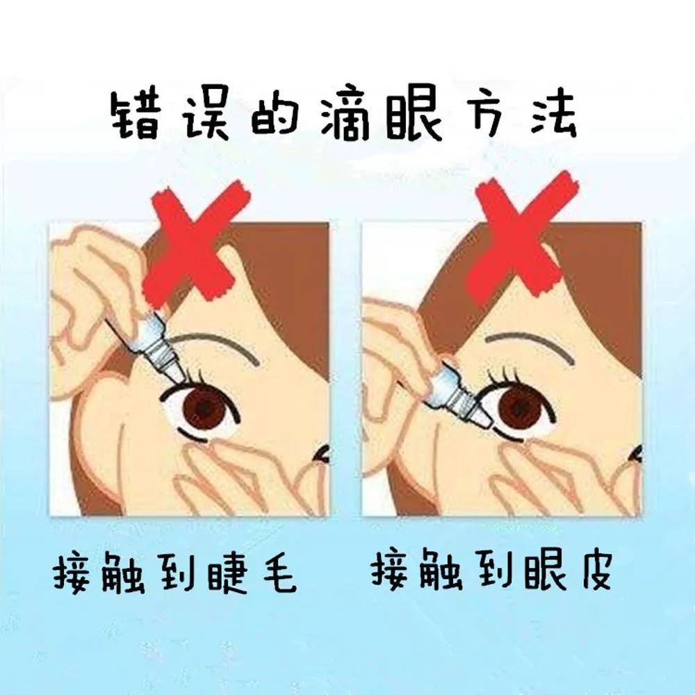 这么多年你的眼药水都白滴了吗?