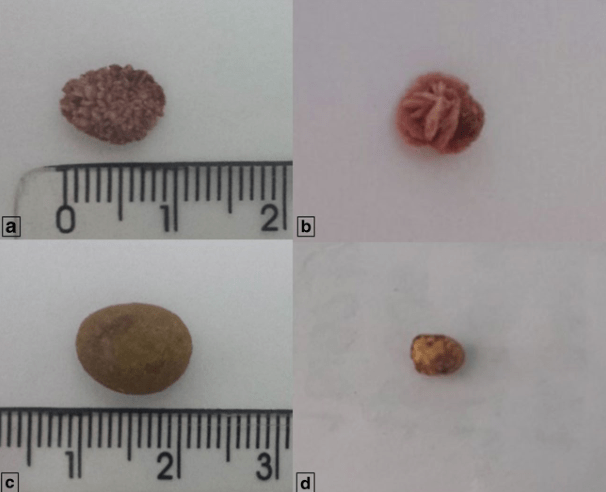 猫膀胱结石:a. 鸟粪石,b. 草酸钙结石,c. 尿酸盐结石,d.