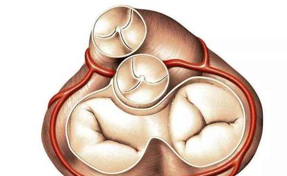 做超声发现"二尖瓣,三尖瓣少量反流",是心脏病吗?_瓣膜