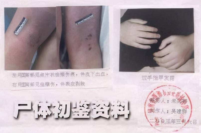 原创湖南21岁女老师猝死宿舍,尸检结果出人意料,男友赔偿5.7万