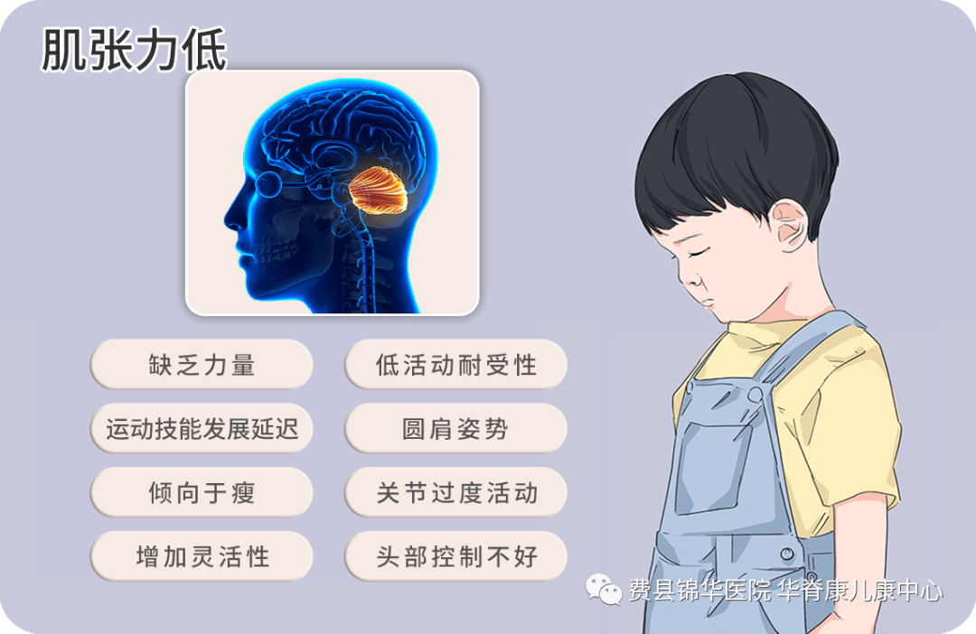 脑瘫孩子的肌张力为什么会出现异常