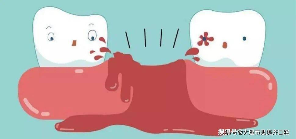 小知识:拔牙窝的恢复是从凝血块开始的,拔牙后24小时左右局部的「纤维