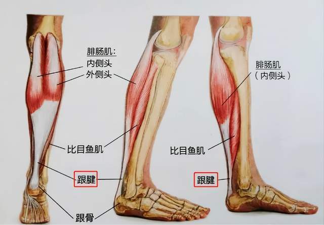 什么是跟腱炎? 跟腱,也就是老百姓口中的"脚筋","大筋".