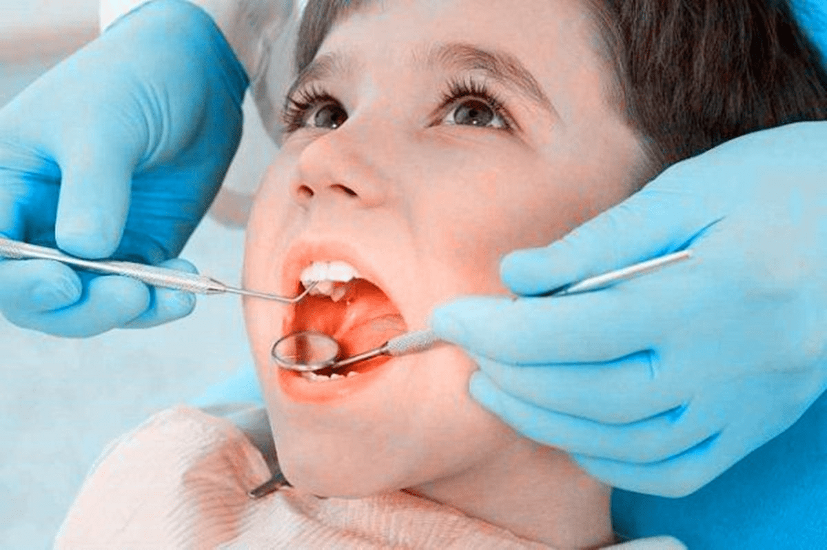 想要孩子牙齿好,从乳牙开始注意,乳牙、换牙阶段重点,一文讲清