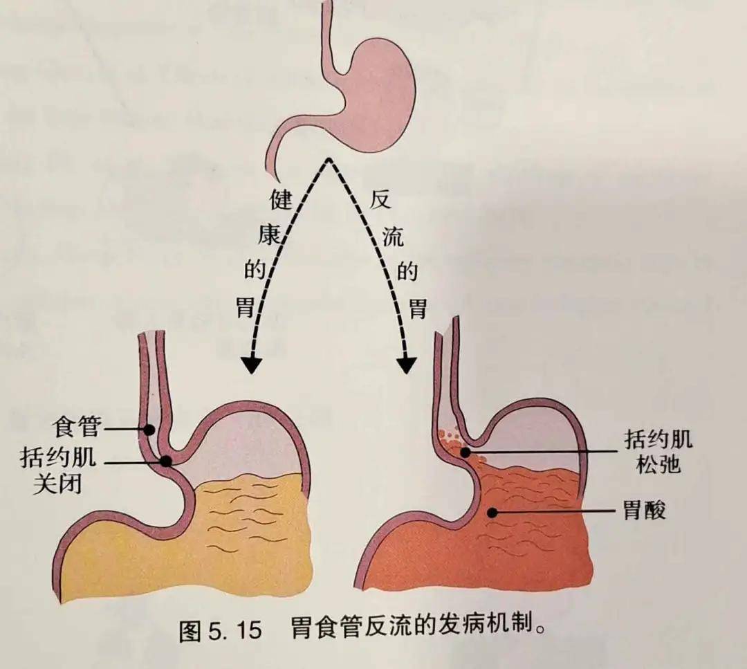 7 消化系统疾病之氢气人群试验_食管_包括_治疗