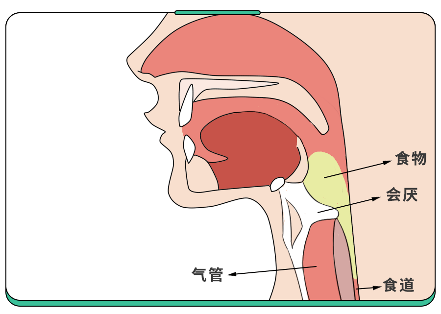 5岁娃嗓子疼进ICU！这病春季高发,重症率高,小孩大人都得防