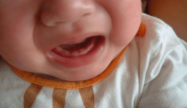 宝宝长牙必然会＂发烧＂？儿科医生辟谣：二者没有直接关系