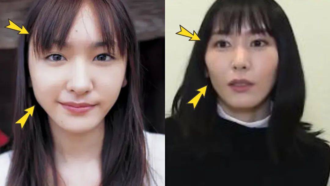 新垣结衣没有评进2022年日本女星top10?_面部_情况_肌肉