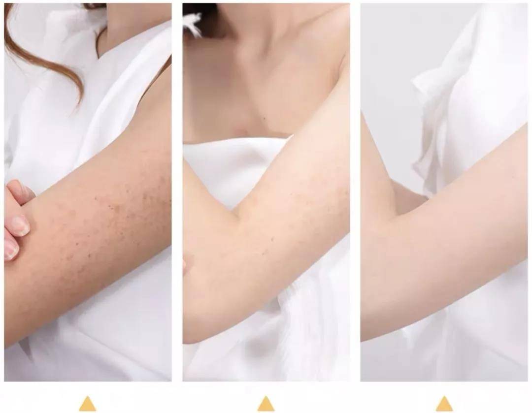 原创迪丽热巴蝴蝶美背杀火了肩骨线时尚完美皮肤又白又嫩真想摸