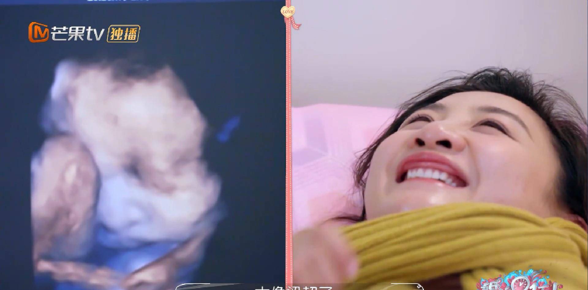 挺大肚穿婚纱嫁有钱人,婆婆慈眉善目,何雯娜产检做b超胎儿软萌_梁超