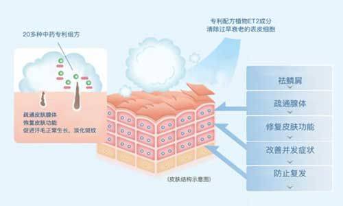 鱼鳞病与排汗有什么关系?