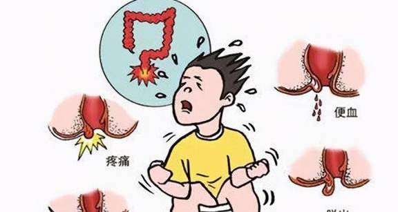 肛门周围经常潮湿、瘙痒，怎么处理好得快？