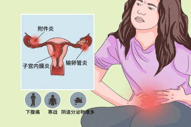 成都真爱医院：为什么会感染盆腔炎？