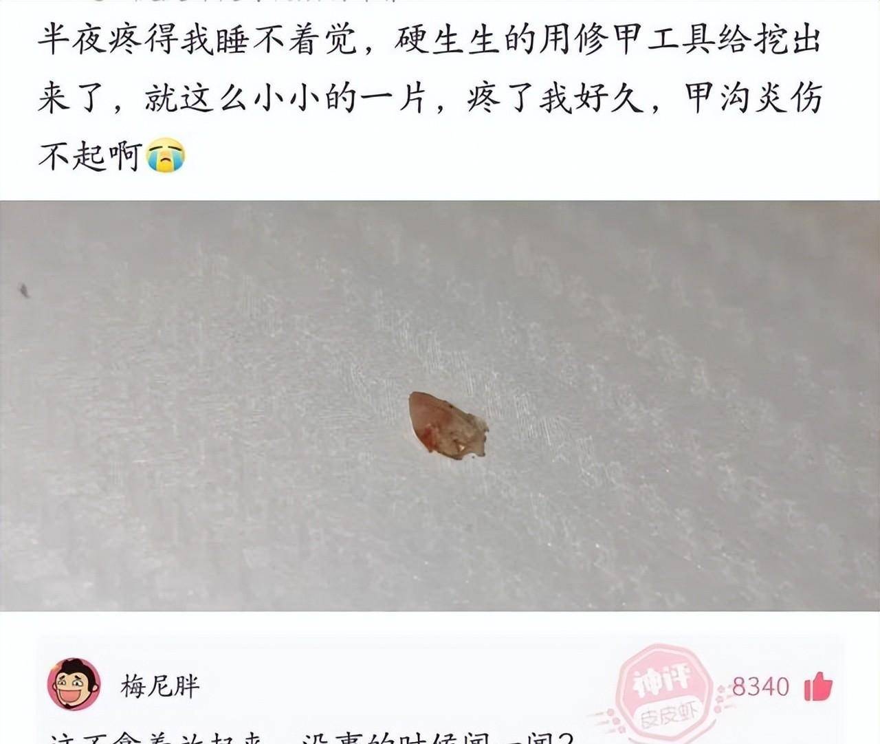 “吃到一半才发现，还认为是脏脏包！”请专业团队抬走吧，哈哈哈