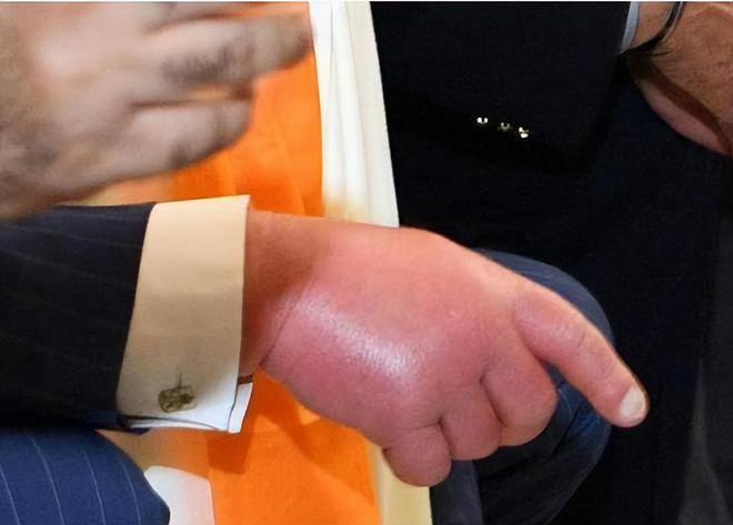 ���˹���㳦�֣�����3ö��ָ��Сָһֱ�����Ŵ����Ƚ��� ...