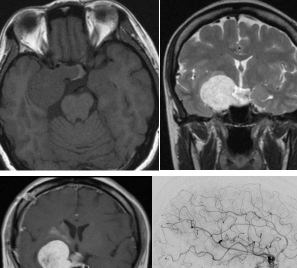 �Լ����没���͹�ע�Թ��������׶������ۺ���ح3���Ӷ�Ƭ ...