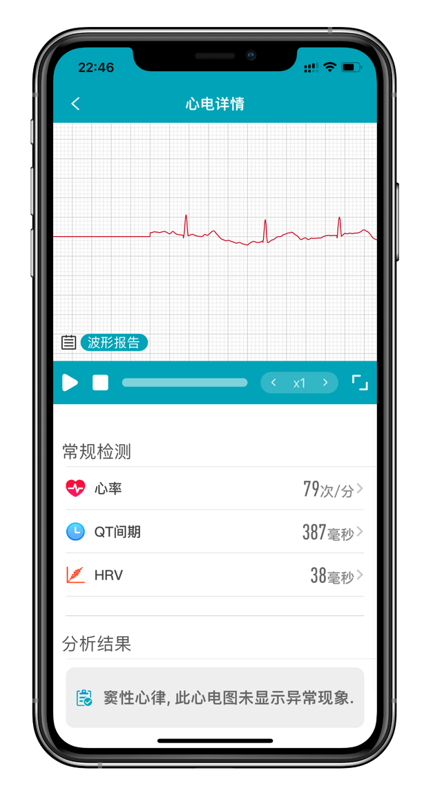 ��������ȫ����⣬dido G28S�����ֱ���������