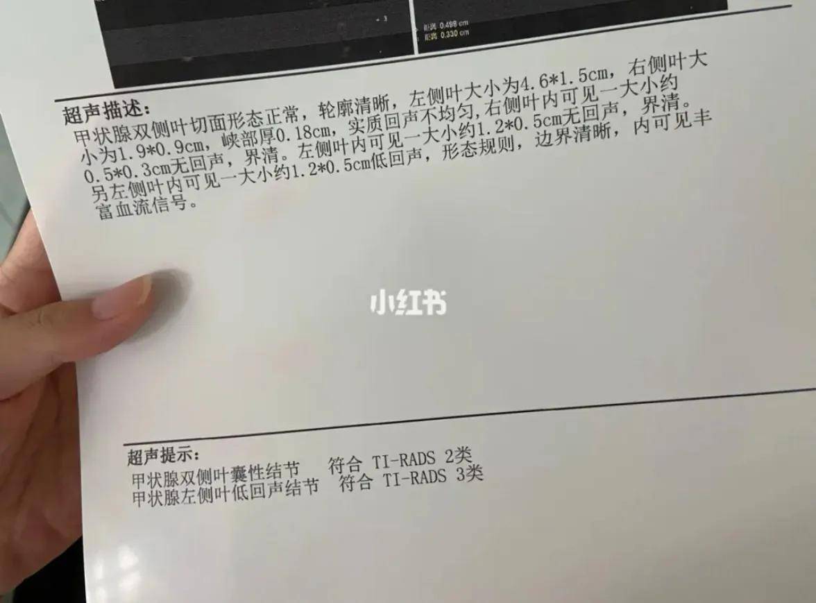 朱医生，我做甲状腺彩超，发现有甲状腺结节，下一步怎么治疗？