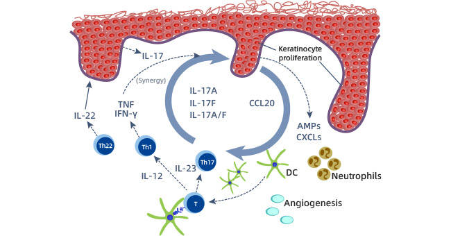 IL-17A：白细胞介素-17家族代表性靶点，助力炎症、免疫、肿瘤性皮肤病治疗！