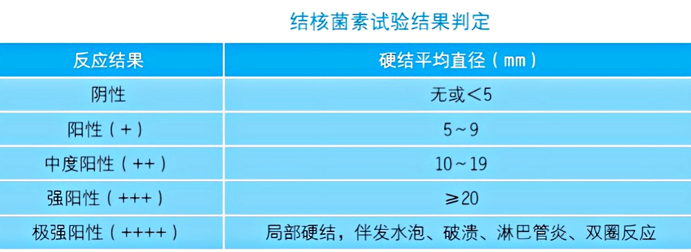 更有可能将疾病传染给他人。五、结核菌素皮肤试验检测后需要注意什么？1.细节注意事项。接种后无需用棉签