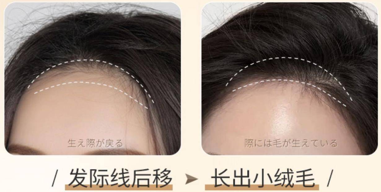 洗發(fā)水哪個(gè)牌子好？防脫洗發(fā)水推薦排行榜