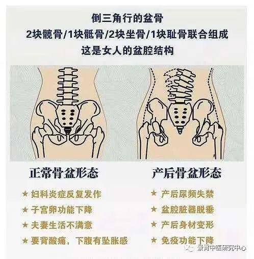 徒手骨盆修复的重要性你不得不知