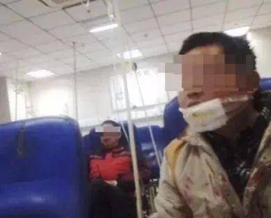可怕!砂轮机又伤人!脖子被切!不要再问为什么要安防护罩!