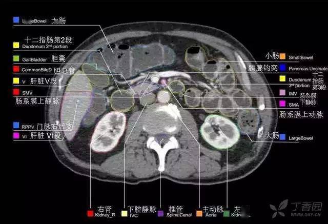 收藏全腹部高清ct图谱淋巴结彩色图谱血管解剖图谱大汇总